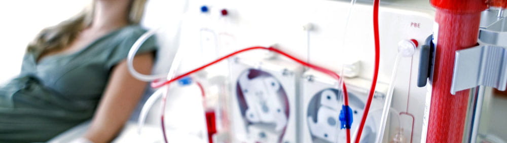 Dialysis